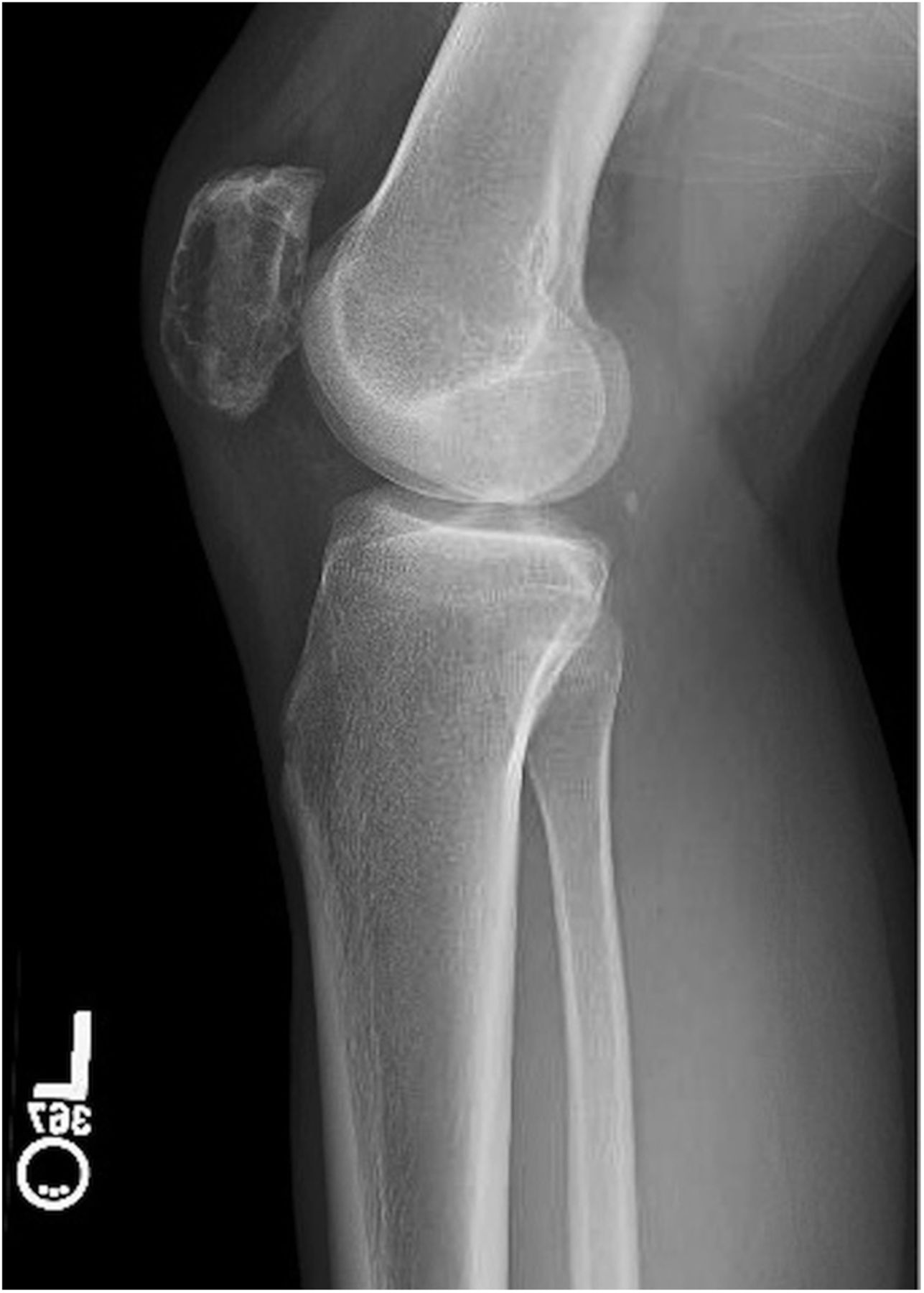 A 33YearOld Man with Left Knee Pain JBJS Image Quiz