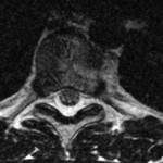 4-A T2-weighted axial magnetic resonance image showing the T7 vertebral body.

