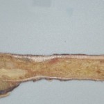 Fig. 4 Gross pathology of the resected femur after bisection.
