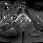 Fig. 2 T2-weighted axial MRI scan.
