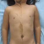 A 6-Year-Old Girl with Knee and Shoulder Pain
