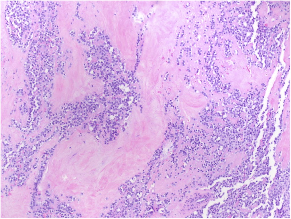 A 65 Year Old Man With Worsening Calf Pain JBJS Image Quiz