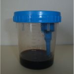 Fig. 3 Upon exposure to air, the urine became darkly pigmented.
