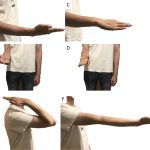 Fig. 5 Range of motion, including supination (Figs. 5-A and 5-B), pronation (Figs. 5-C and 5-D), and flexion and extension (Figs. 5-E and 5-F) at the 2-year follow-up.
