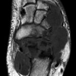 Fig. 7-A T1-weighted axial MRI without contrast.
