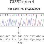 Fig. 6 TGFB-1 mutation as requested in December 2019. Chromatogram showing the c.667T>C change in the proband and carrier daughter that was not seen in unaffected relatives.

