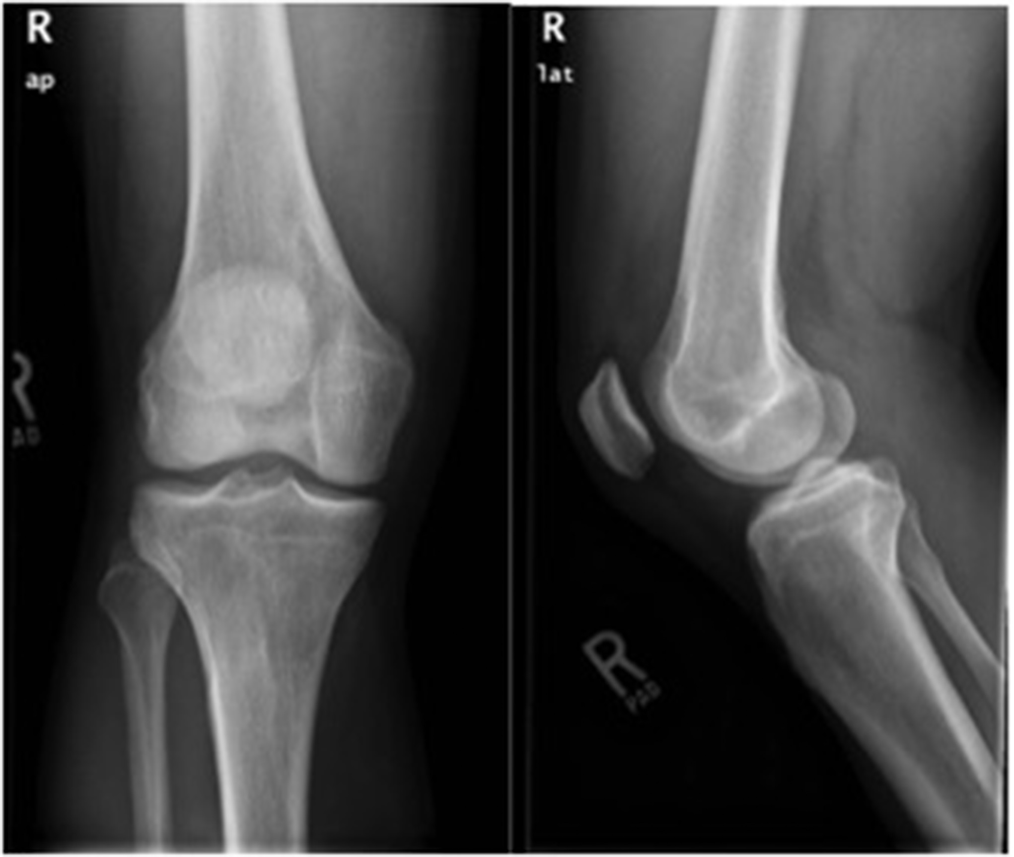 Anatomy of the Knee joint Quiz